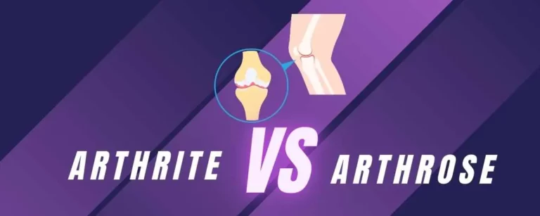Différence entre arthrite et arthrose